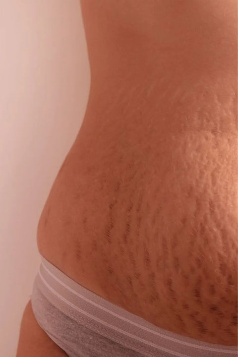 Antes de usar la crema Centella Asiatica