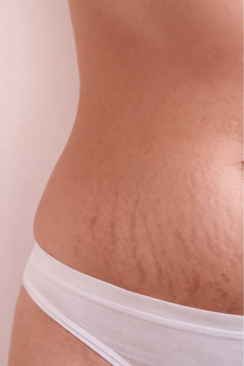 Después de usar la crema Centella Asiatica